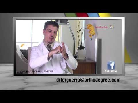 003 DR GUERRA CUALES SON LAS CAUSAS DE LA ARTROSIS DE HOMBRO