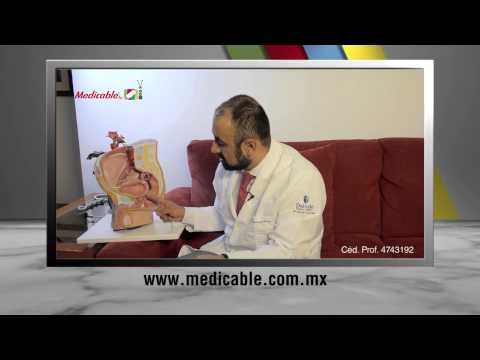 ¿Por qué es importante el tacto rectal para el diagnóstico de problemas en la próstata?