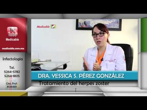 ¿Cómo se puede tratar el herpes zoster?