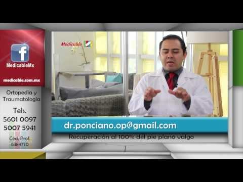 ¿Se puede lograr una recuperación al 100% del pie plano valgo?