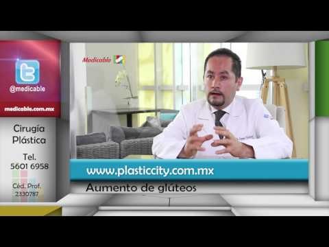 ¿En qué consiste la implantación quirúrgica de células grasa en los glúteos?