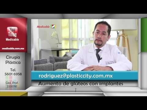 ¿Los implantes en glúteos dejan resultados naturales?