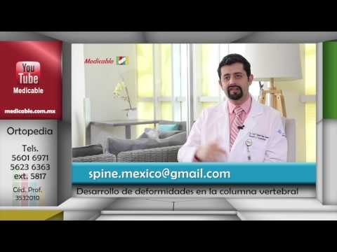 ¿Quién está en riesgo de desarrollar deformidades de la columna vertebral?