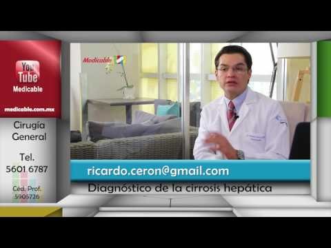 005 COMO SE DIAGNOSTICA LA CIRROSIS HEPATICA