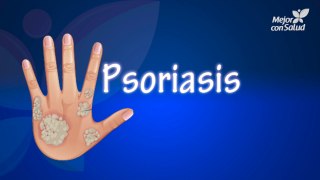 Psoriasis: tipos, causas y tratamientos