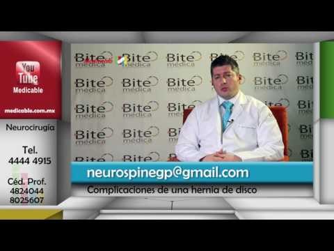 De no atenderse una hernia de disco, ¿cuáles son las posibles complicaciones?