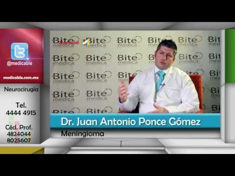 ¿Quién está en riesgo de desarrollar un meningioma?