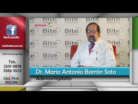 ¿Quién está en riesgo de presentar adenoamigdalitis?