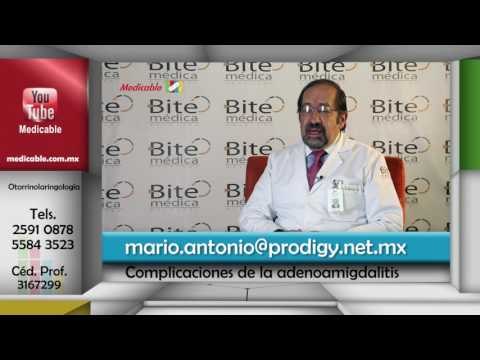 ¿Qué complicaciones puede presentar la adenoamigdalitis?