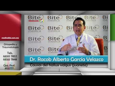 ¿Cuáles son las causas del hallux valgus (juanete)?