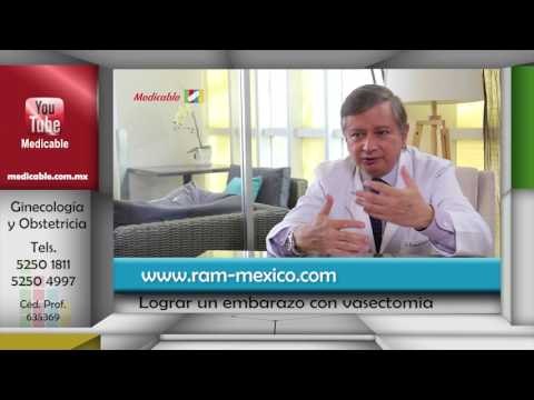 Una pareja donde el hombre tiene vasectomía, se puede embarazar.