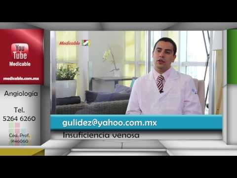 004 QUE TAN FRECUENTE ES LA INSUFICIENCIA VENOSA