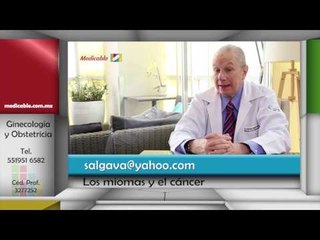002 LOS MIOMAS  PUEDEN DESARROLLAR ALGUN TIPO DE CANCER