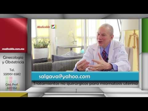 006 QUE OPCIONES DE TRATAMIENTOS NO QUIRURGICOS EXISTEN PARA LA MIOMATOSIS UTERINA