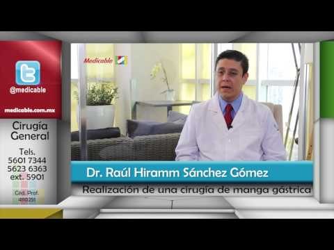 008 COMO AE REALIZA LA CIRUGIA DE MANGA GASTRICA