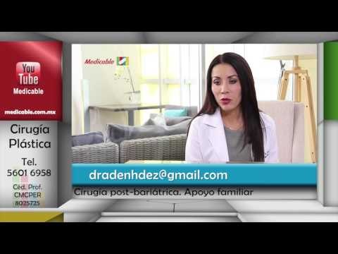 ¿Qué tan importante es el apoyo familiar para un paciente con cirugía post-bariátrica?