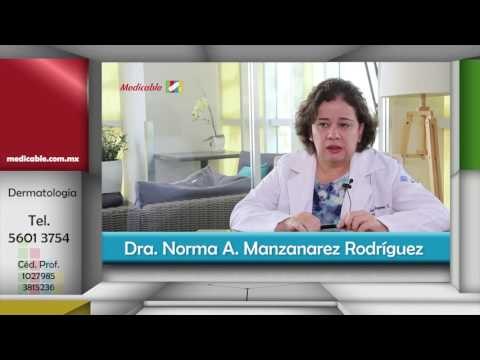¿Qué papel juegan las terapias alternativas para el cáncer de piel basocelular?