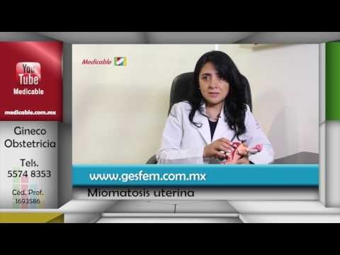 ¿Qué tipo de problemas clínicos puede ocasionar la miomatosis uterina?
