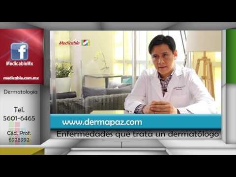 002 CUALES SON LAS ENFERMEDADES DE LA PIEL MAS FRECUENTES QUE TRATA UN DERMATOLOGO