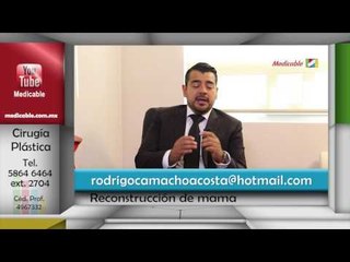 011 CUANTO TIEMPO NECESITO ESPERAR PARA LA RECONSTRUCCION DE MAMA