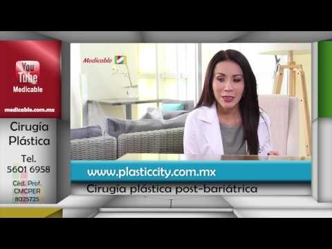 ¿Qué es la cirugía plástica post bariátrica?