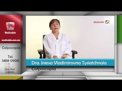 013 QUE OTROS PADECIMIENTOS SE PUEDEN DETECTAR EN UNA COLPOSCOPIA