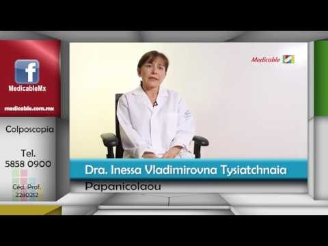 015 CADA CUANDO SWE DEBE REALIZAR UN PAPANICOLAOU Y EN QUE CONDICIONES
