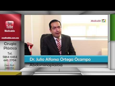 004 COMO SE REALIZA UNA ABDOMINOPLASTIA