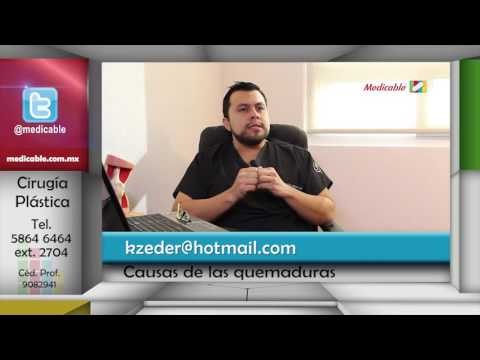 ¿Cuáles son las causas más frecuentes por las que se provoca una quemadura?