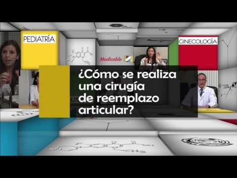 007 COMO SE REALIZA UNA CIRUGIA DE REEMPLAZO DE ARTICULAR