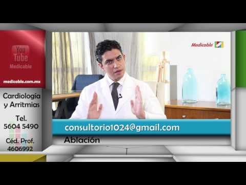 ¿Qué complicaciones podrían suceder durante una ablación de fribrilación auricular?