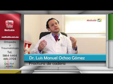 006 ES VERDAD QUE LAS FACTURAS DE CADERA PUEDEN OCASIONAR LA MUERTE