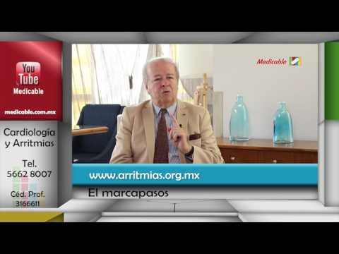 ¿Tengo que cambiar mi estilo de vida si me colocan un marcapasos? ¿Puedo hacer ejercicio?