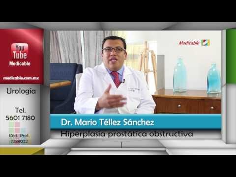 ¿Cuáles son los síntomas más frecuentes de la hiperplasia prostática obstructiva?