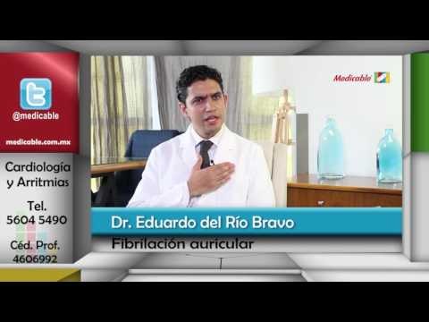 ¿Cómo puedo saber si tengo fibrilación auricular?