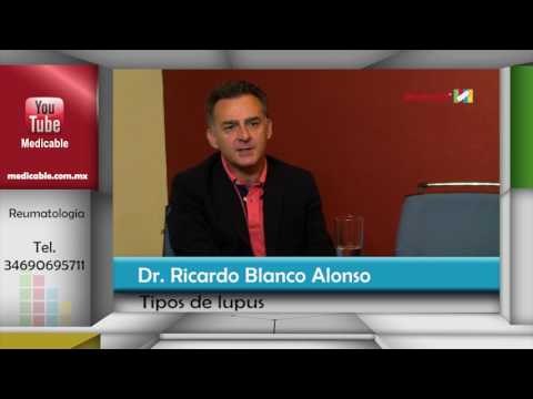 ¿Cuáles son los tipos de lupus?
