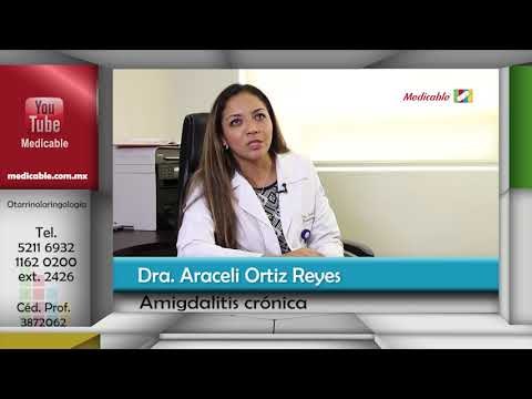 ¿Cuáles son los síntomas de la amigdalitis crónica?