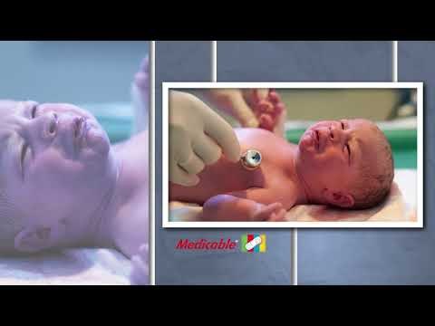 APNEA NEONATAL RESPIRATORIA