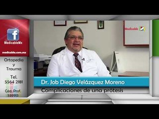 ¿Cuáles son las complicaciones al colocar una prótesis?