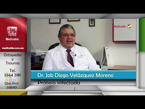 ¿Cómo saber si existe una infección en la prótesis?
