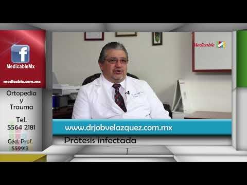 ¿Cómo se trata la infección de una prótesis?
