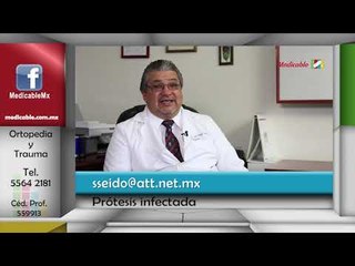 ¿Se debe quitar la prótesis cuando hay infección?