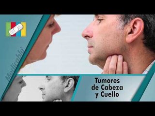 TUMORES DE CABEZA Y CUELLO