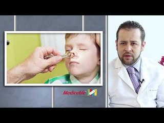 DESVIACIÓN DE TABIQUE NASAL EN NIÑOS