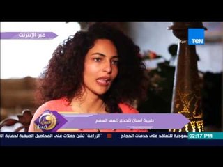 عسل أبيض - طبيبة أسنان تتحدى ضعف السمع