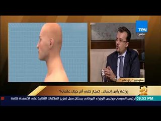 رأى عام - استشاري جراحة مخ وأعصاب: مصر ما زالت عاجزة عن إصدار تشريعات تنظم عملية نقل الأعضاء