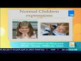 صباح الورد - فقرة خاصة عن مشاكل التوحد عند الأطفال مع الدكتور محمد المهدي