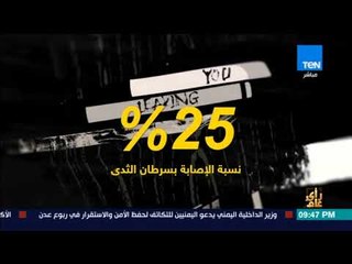 رأي عام | فيديوجراف - اليوم العالمي للسرطان.. أرقام مرعبة