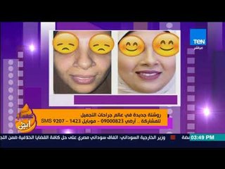 عسل أبيض - روشتة جديدة في عالم جراحات التجميل