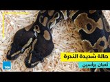 قصص TeN- حالة شديدة الندرة ثعبان برأسين